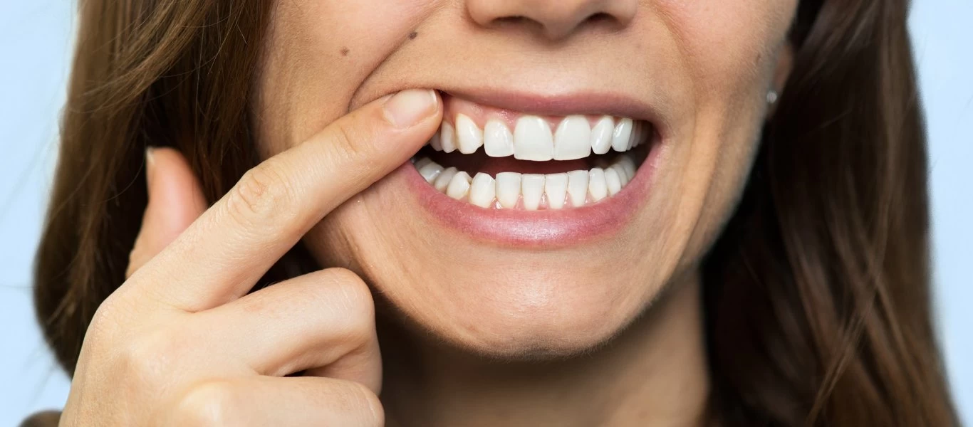 Υποχώρηση ούλων: Ποιοι είναι οι τρόποι αντιμετώπισης